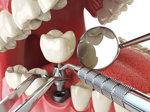 Best Pediatric Emergency Dentist in Camdenton, MO